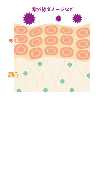 シワの原因となる皮溝が出来る
